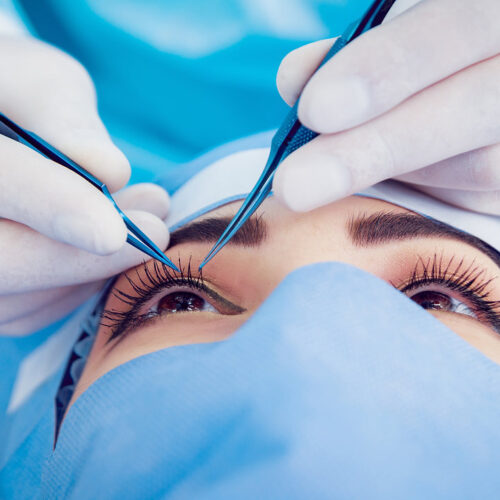 Ophthalmic Eye Instruments